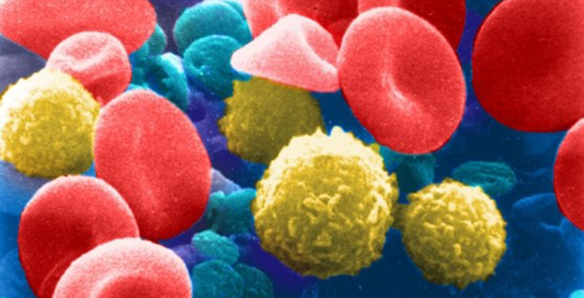 Red and white blood cells. Image: National Cancer Institute/colorized by Broad Communications